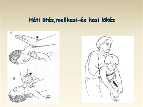 csecsemő háti ütés
