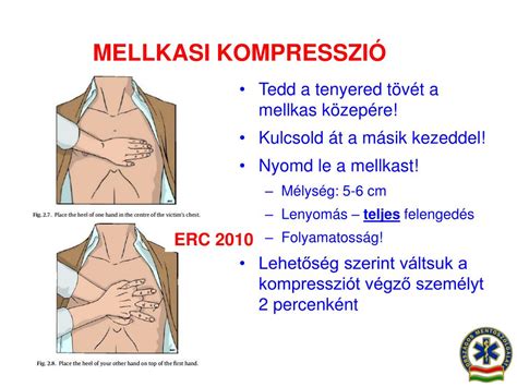 csecsemő mellkasi kompresszió