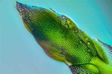 Egészséges hüvelyi flóra mikroszkóp alatt