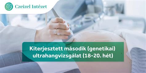 második genetikai ultrahang 20. hét