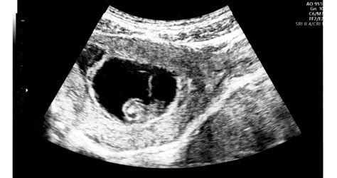 Összehasonlítás: MR, ultrahang, CT és röntgen alkalmazhatósága terhesség alatt