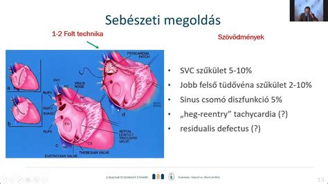 Veleszületett szívhibák típusai
