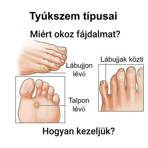 Illusztráció egy iskolai levelezésről, amely érzékeny témát érint