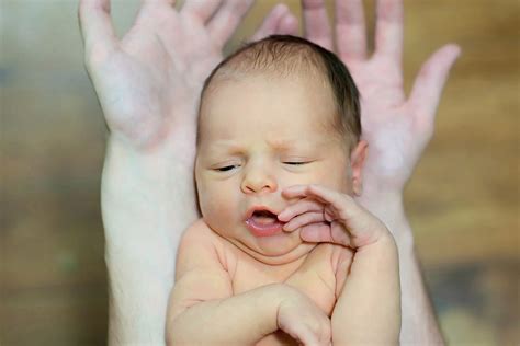 Újszülöttkori sárgaság