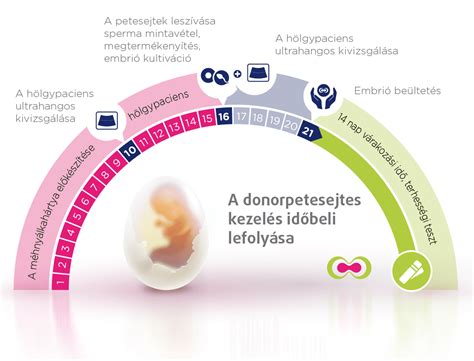 Infografika az IVF folyamatáról