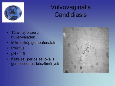 A hüvelyváladék típusai és normál állapota