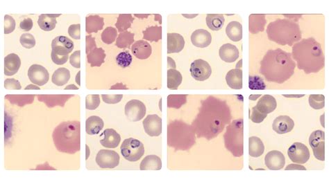 Malária zónák a WHO szerint