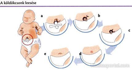 Újszülött ellátása