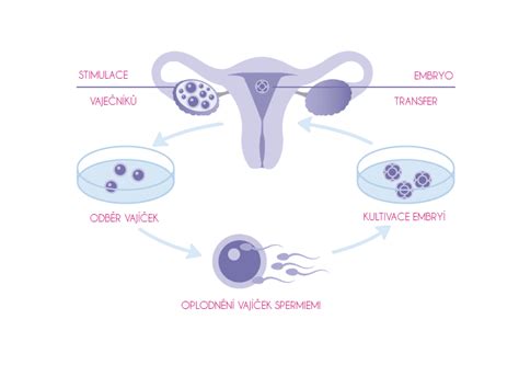 in vitro fertilizáció folyamata