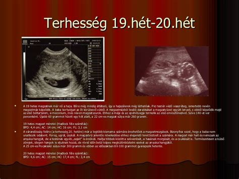 18 hetes magzat ultrahangon