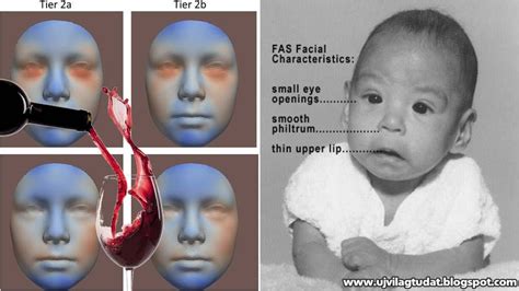 Baba arcának figyelése