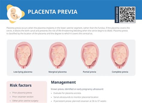 Ultrahangfelvétel placenta praeviáról