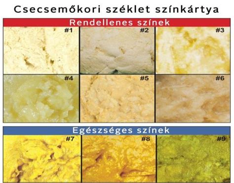 Csecsemő székletszínskála