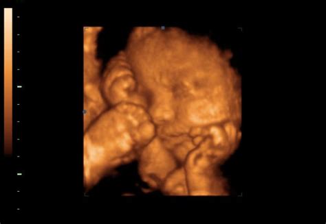 32 hetes magzat fejlődése