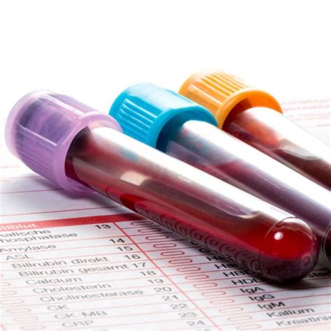 Laboratóriumi vizsgálat bébiétel összetételének elemzése