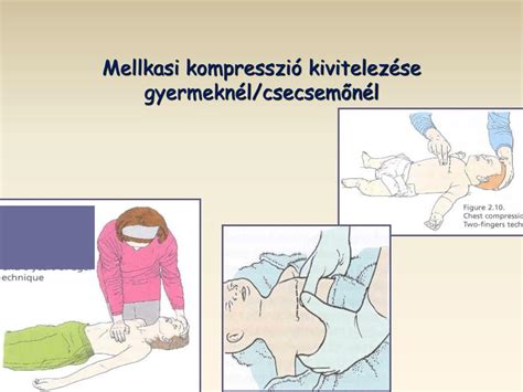 Gyermek mellkasának és hátának balzsamozása