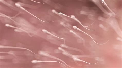 Sématicus ábra a spermiumok morfológiai rendellenességeiről