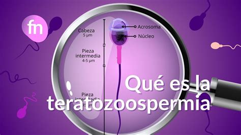 Infografika a teratozoospermia lehetséges okairól