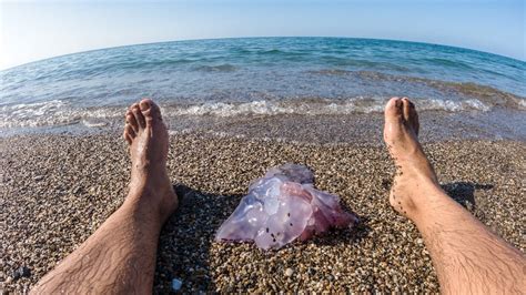 Tünetek medúzacsípés után