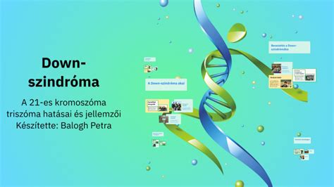 Infografika a Down-szindróma jellemzőiről