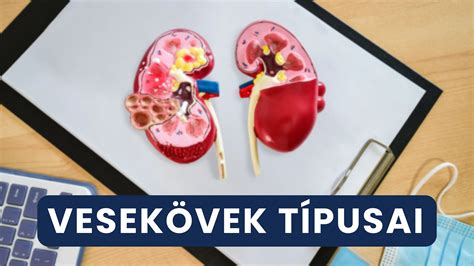 Vesekő figyelmeztetés