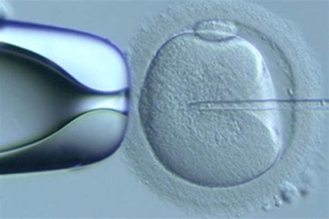 ICSI mikroszkópos felvétel