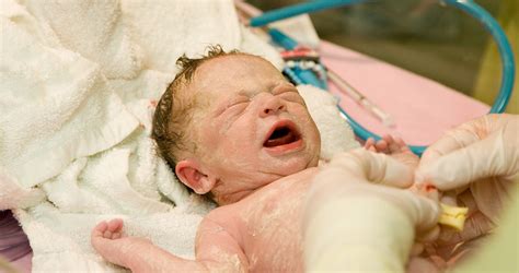 Újszülött csípőízületének vizsgálata