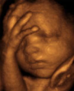 3D ultrahang felvétel egy magzatról
