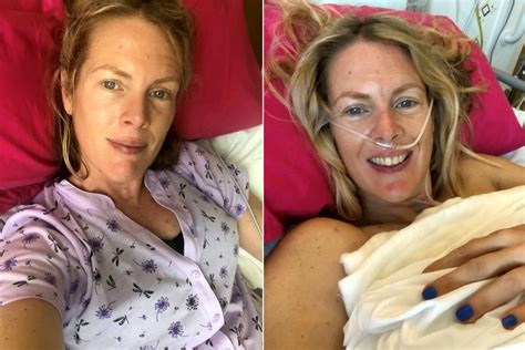 gyulladásos mellrák