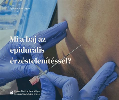 Epidurális érzéstelenítés folyamata
