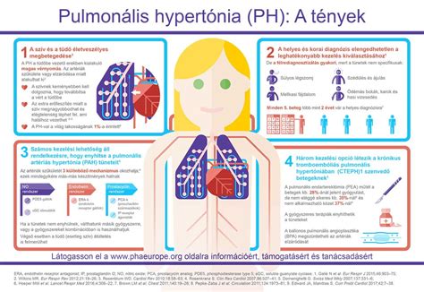 Infografika az izomtónus eltéréseiről (hypotónia vs. hypertónia)