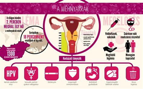 Infografika a mellrák kockázati tényezőiről