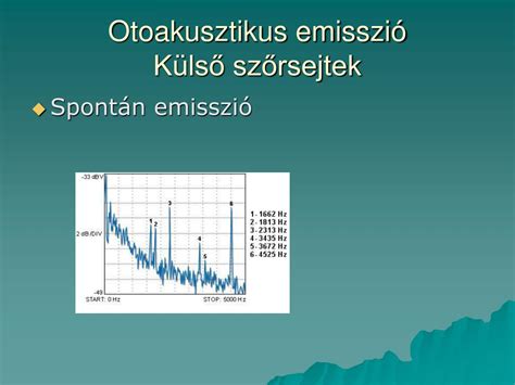 Otoakusztikus emisszió vizsgálata