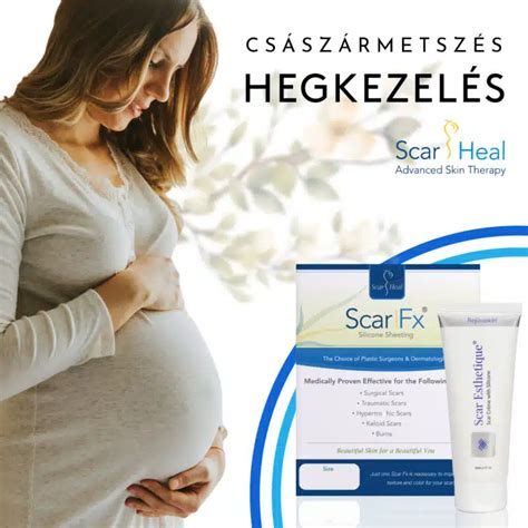 A császármetszés utáni sebkezelés