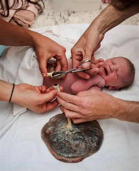 A méhlepény leválása