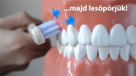 A helyes fogmosási technika