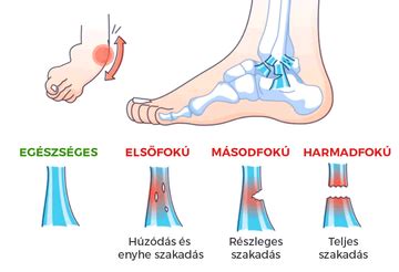 Látványos ábra a boka belső részének anatómiájáról, kiemelve az ízületeket és inakat