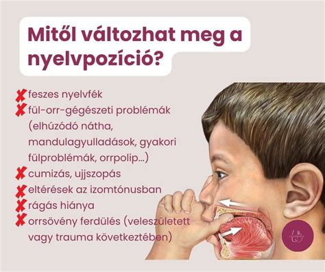 rajz, amely a nyelvlökéses nyelést illusztrálja