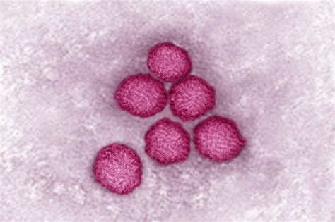 A cytomegalovírus mikroszkópos képe