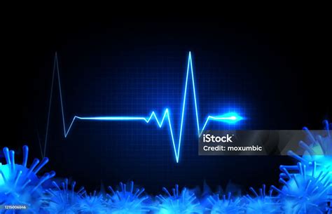 szívverés mintázat