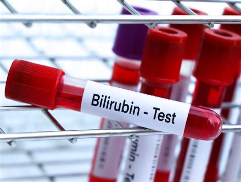 Vörösvértestek lebomlása és bilirubin képződés