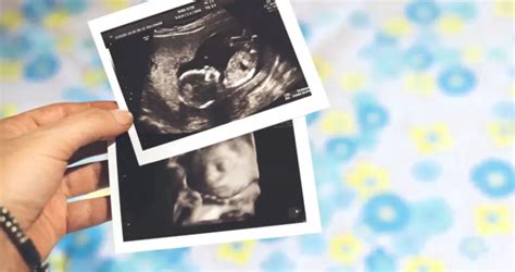 Ultrahangos magzatvizsgálat