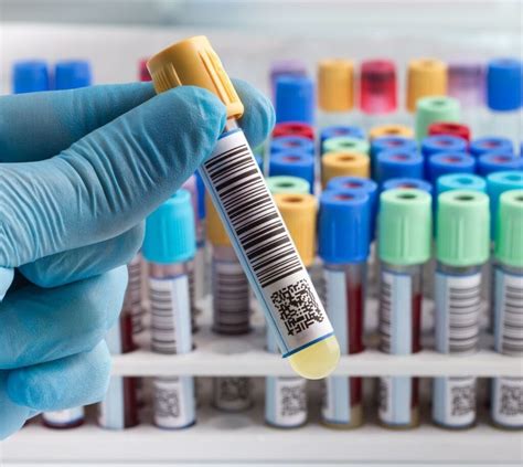 Infografika a laborvizsgálatok előkészületeiről