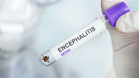 Kullancsencephalitis elleni védőoltás