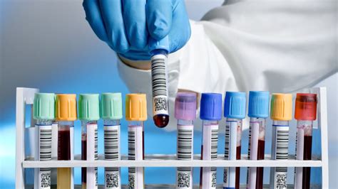 Laboratóriumi vizsgálatok vérvétellel