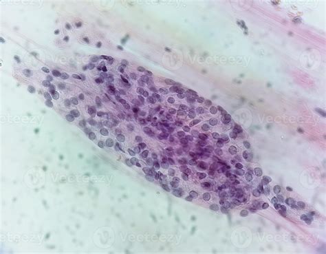 mikroszkópos kép Trichomonas vaginalis parazitáról
