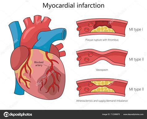 Különböző típusú babahinták