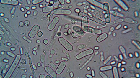 A Meningococcus baktérium ábrája
