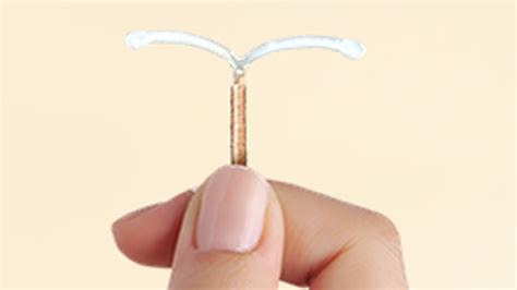 réz spirál elhelyezése