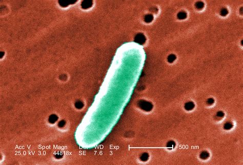 E. coli baktériumok mikroszkóppal